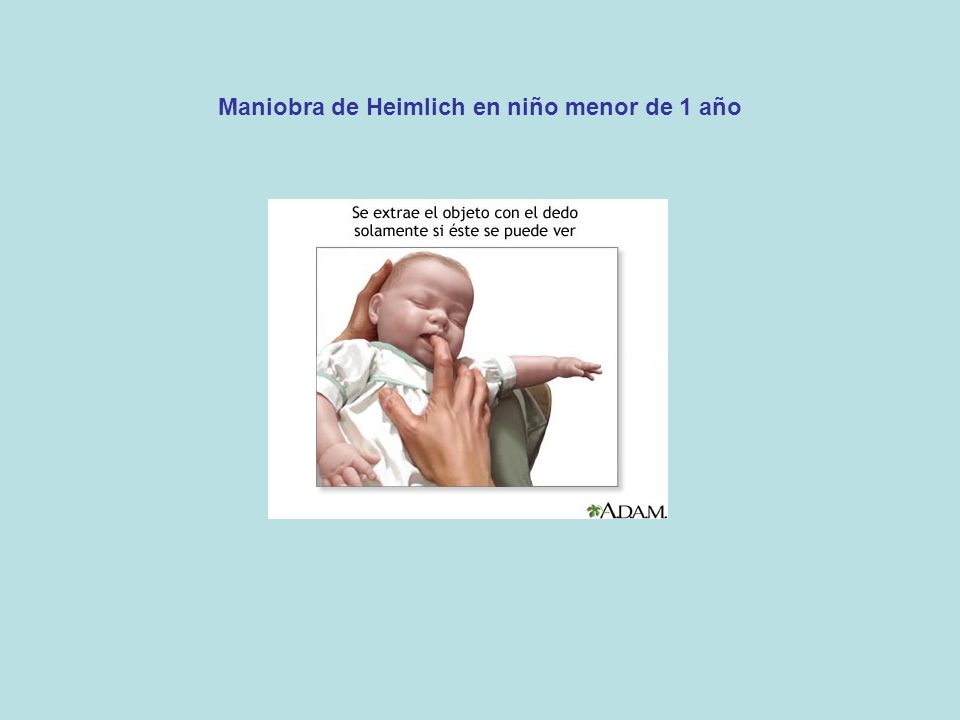 De heimlich en video maniobra ninos
